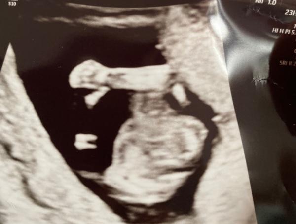 Bild zu FA Termin - Forum für Juni - Mamis