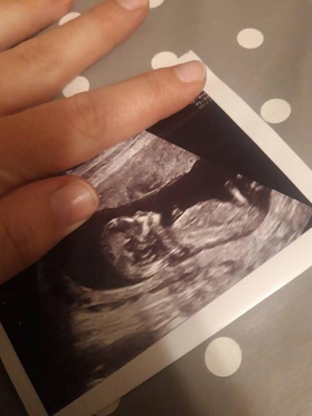 Bild zu Zurück vom Frauenarzt - Forum für Juni - Mamis
