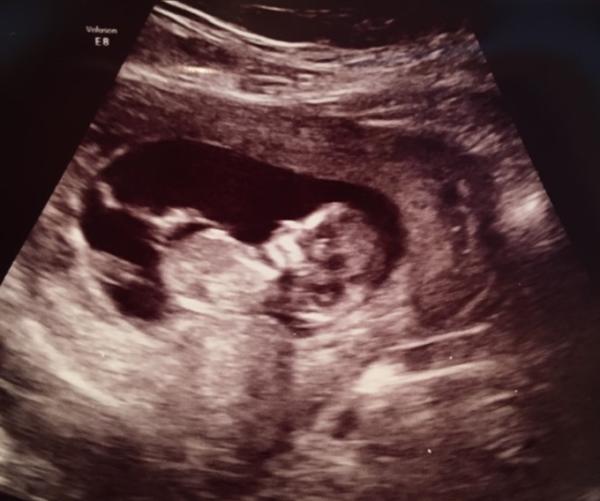 Bild zu Seht ihr schon etwas? :) - Forum für Juni - Mamis