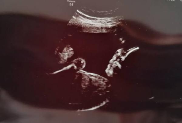 Bild zu Babykino - Forum für Juni - Mamis