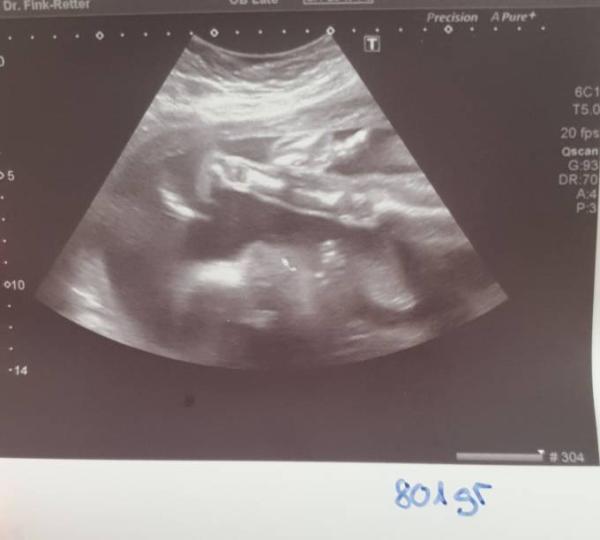 Bild zu Wie ein kleiner Klappspaten - Forum für Juni - Mamis