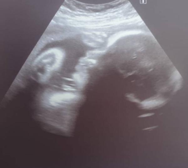 Bild zu 1. Portrait unserer geliebten Peanut  - Forum für Juni - Mamis