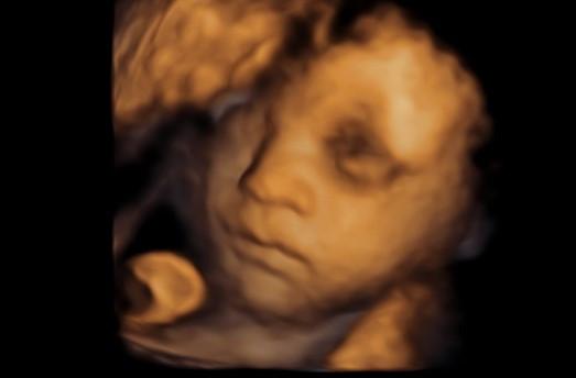 Bild zu Ultraschall und Babybauch - Forum für Juni - Mamis