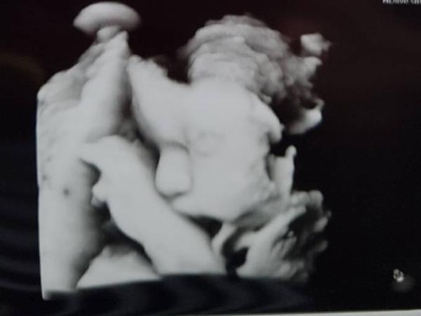 Bild zu Erneute Feindiagnostik - Forum für Juni - Mamis