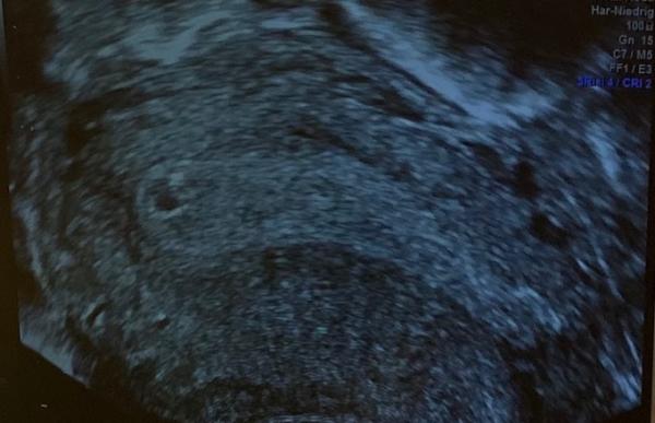 Bild zu Eure bilder, euer befinden đ - Forum fĂŒr Juni - Mamis