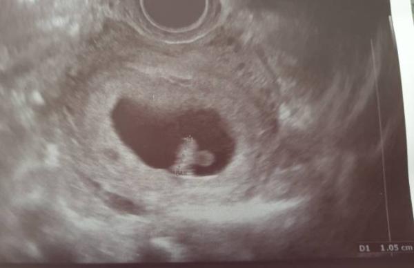 Bild zu Heute Termin beim Gyn gehabt - Forum für Juni - Mamis