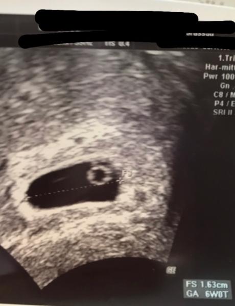 Bild zu Erster Frauenarzttermin - Forum für Juni - Mamis