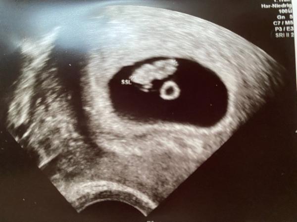 Bild zu Ultraschall 7+1-3 - Forum für Juni - Mamis