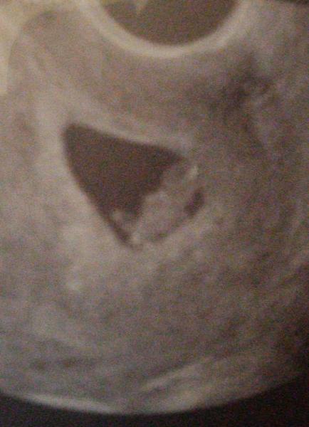 Bild zu Heute fa termin - Forum für Juni - Mamis