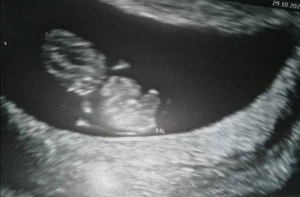 Bild zu Endlich erster Ultraschall 😍 - Forum für Juni - Mamis