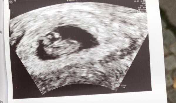 Bild zu Brauner Ausfluss - Forum für Juni - Mamis