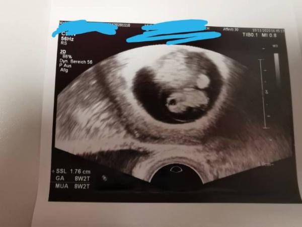 Bild zu Erster Termin - Forum für Juni - Mamis