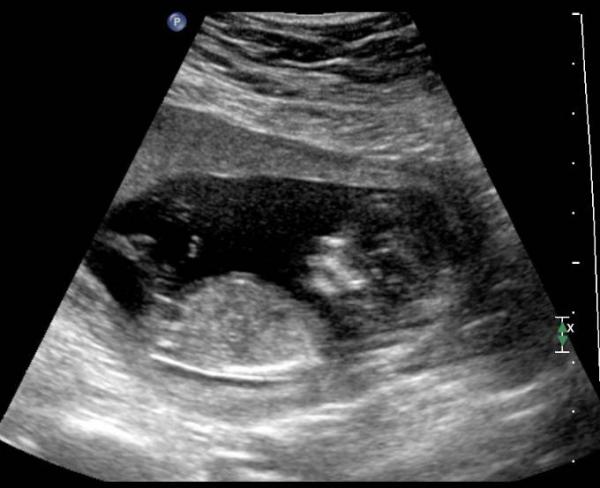 Bild zu erstes Outing - Forum für Juni - Mamis