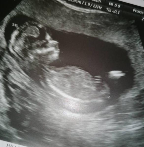 Bild zu Ultraschall 😍 - Forum für Juni - Mamis