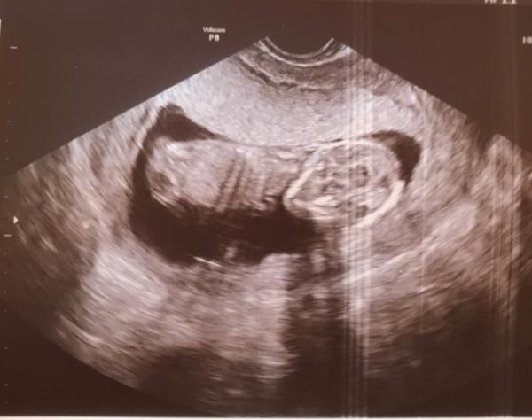 Bild zu FA-Termin - Forum für Juni - Mamis