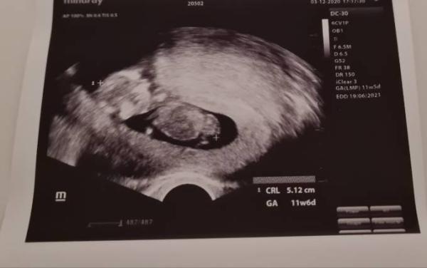 Bild zu Gestern Vorsorge - Forum für Juni - Mamis