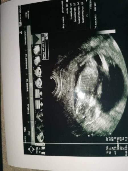 Bild zu Erkennt ihr das Geschlecht? - Forum für Juni - Mamis