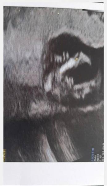 Bild zu Mädchen oder Junge - Forum für Juni - Mamis