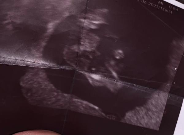 Bild zu Junge oder Mädchen? :-) - Forum für Juni - Mamis