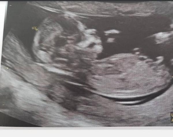 Bild zu Nub oder Skull Theorie - Forum für Juni - Mamis