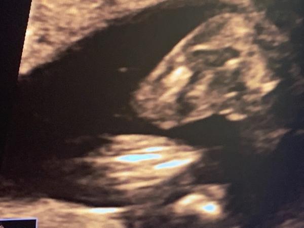 Bild zu Outing 🥰 - Forum für Juni - Mamis