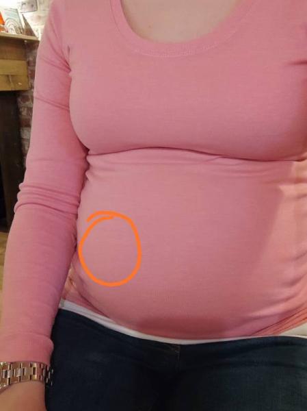 Bild zu Schmerzhafte Kindsbewegungen? - Forum für Juni - Mamis