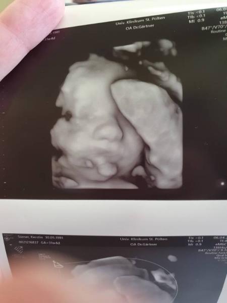 Bild zu Baby nuckelt an Nabelschnur - Forum für Juni - Mamis