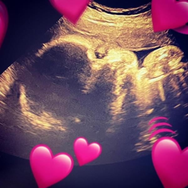 Bild zu Letzter Ultraschall 🥰 - Forum für Juni - Mamis