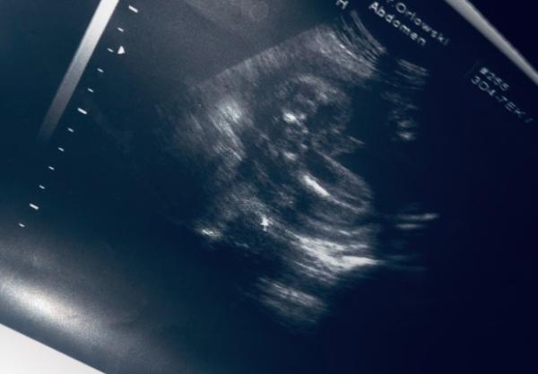 Bild zu Baby Outing, was denkt Ihr? - Forum für Juni - Mamis