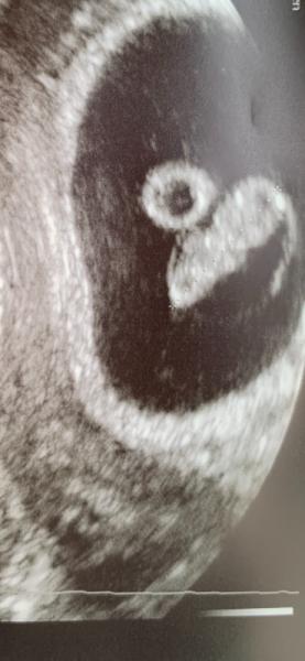 Bild zu Hatte endlich meinen 1. Termin ♥️ - Forum für Juni - Mamis