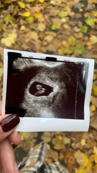 Bild zu Glücklich und wir können es immernoch nicht glauben - Forum für Juni - Mamis