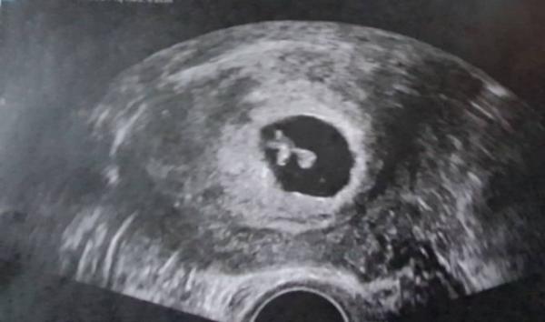 Bild zu Erleichterung - Forum für Juni - Mamis