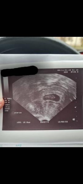 Bild zu 2. FA Termin - Forum für Juni - Mamis