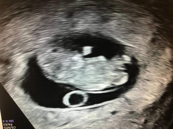 Bild zu Gestern 2. FA - Termin mit Baby TV - Forum für Juni - Mamis