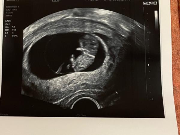 Bild zu 2.Ultraschall- ich bin so verliebt - Forum für Juni - Mamis