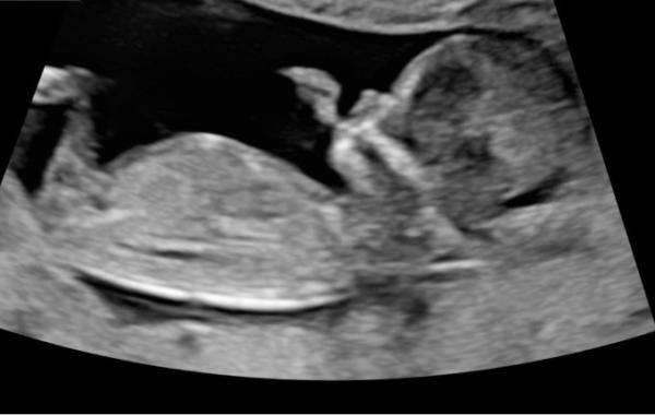 Bild zu Mädchen oder Junge - Forum für Juni - Mamis