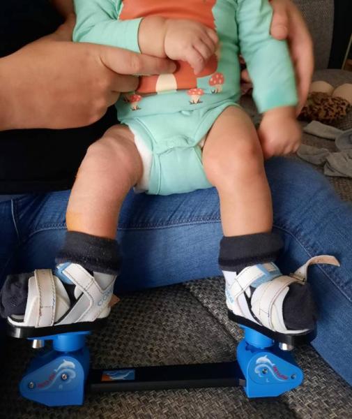 Bild zu Baby (9 1/2 Wochen) schwitzt extrem stark im Schuh - Forum für Juni - Mamis