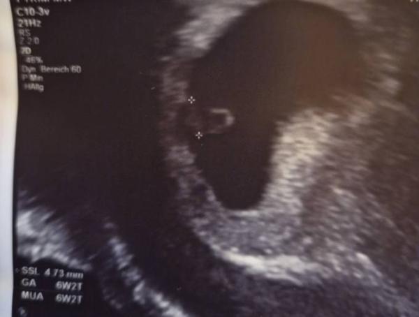 Bild zu Unser erstes Foto ❤️ - Forum für Juni - Mamis