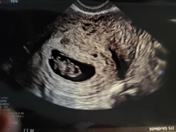 Bild zu Woow ultraschall - Forum für Juni - Mamis