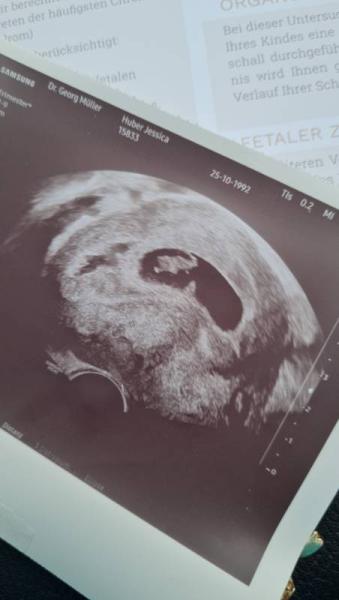 Bild zu 1 US beim FA - Forum für Juni - Mamis