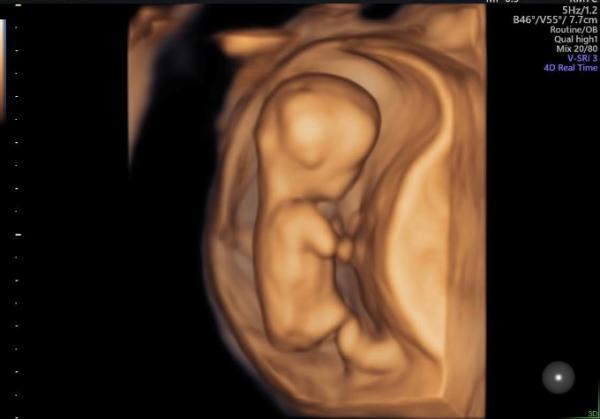 Bild zu Hatte auch großen Ultraschall :D - Forum für Juni - Mamis