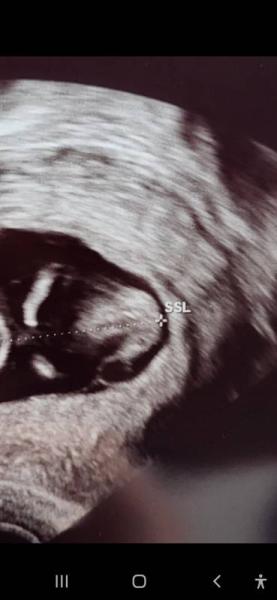 Bild zu Langeweile 😄 was meint ihr? - Forum für Juni - Mamis