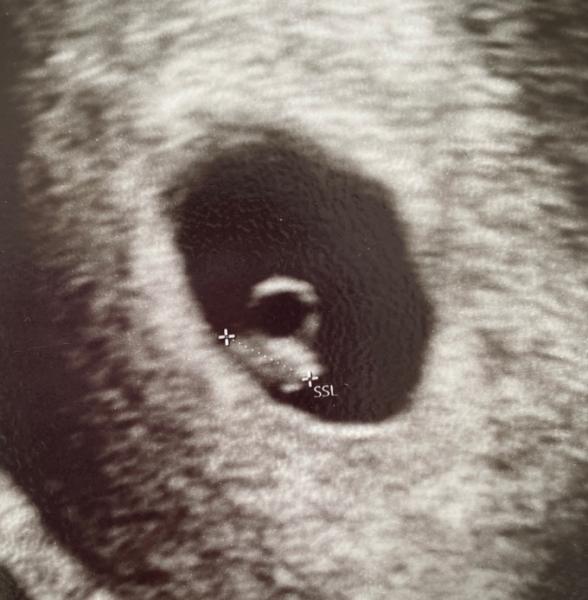Bild zu Erster Termin :)… - Forum für Juni - Mamis