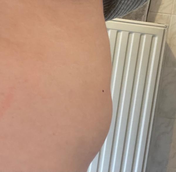 Bild zu Baby Querlage? - Forum für Juni - Mamis