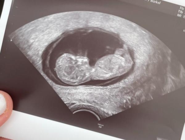 Bild zu Geschlecht - Forum für Juni - Mamis