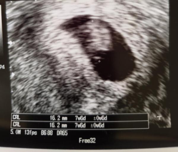 Bild zu Juni Baby - Forum für Juni - Mamis