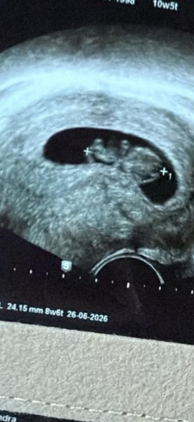 Bild zu Größe Baby - Forum für Juni - Mamis