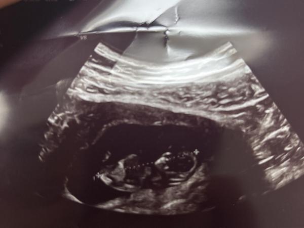 Bild zu NUB oder Ramzi - Forum für Juni - Mamis