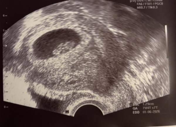 Bild zu NUB oder Ramzi - Forum für Juni - Mamis