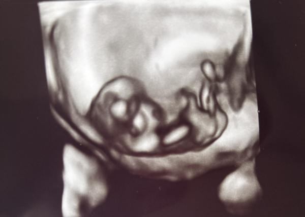 Bild zu NUB oder Ramzi - Forum für Juni - Mamis